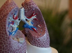 Longfysiotherapie MTC Zoetermeer met anatomisch model van longen
