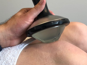 Shockwavetherapie apparatuur bij MTC Zoetermeer